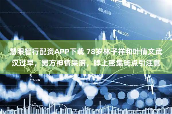 慧眼智行配资APP下载 78岁林子祥和叶倩文武汉过早，男方神情呆滞，脖上密集斑点引注意
